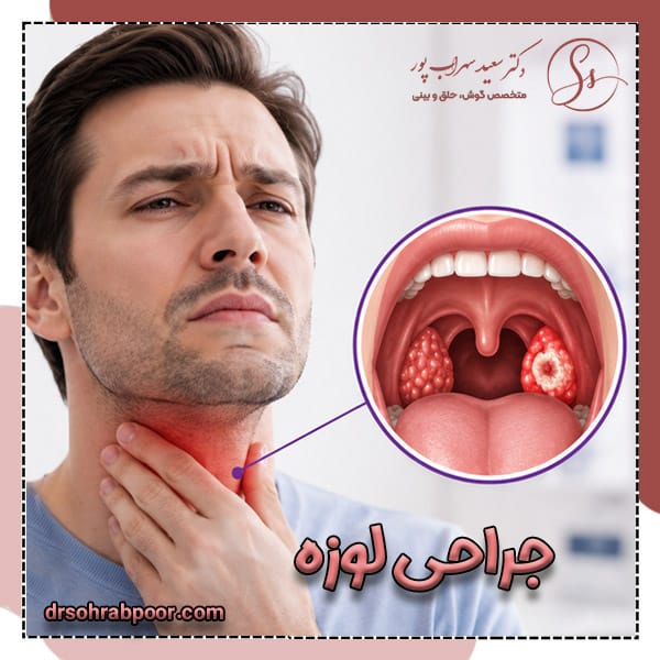 جراحی لوزه
