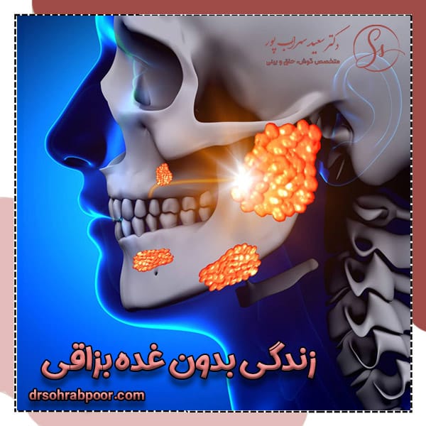 زندگی بدون غده بزاقی + دکتر سعید سهراب پور