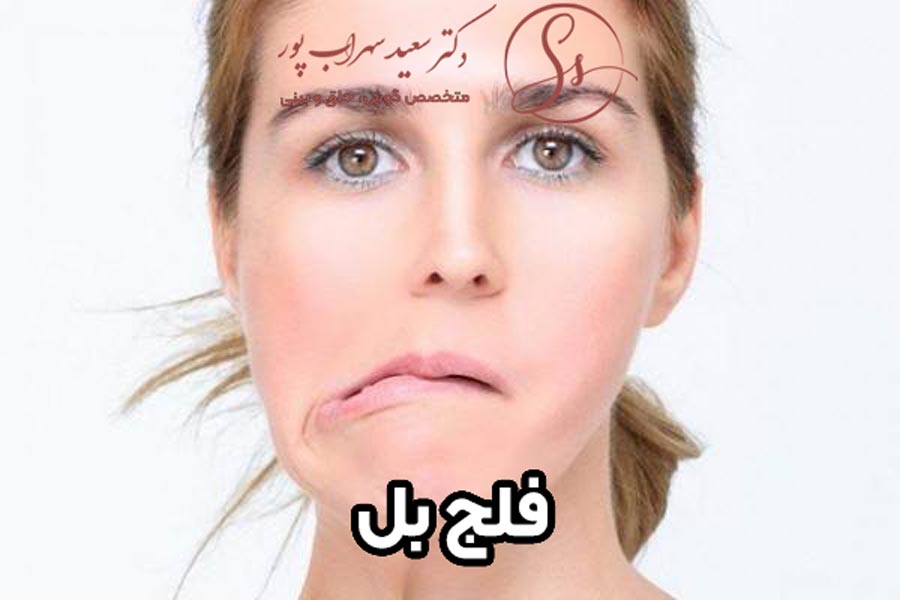 فلج بل