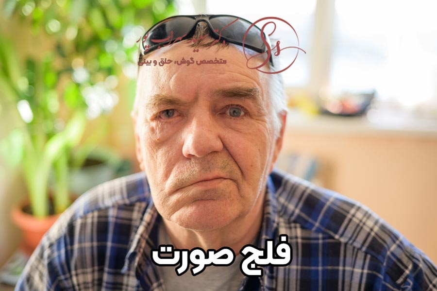 فلج صورت