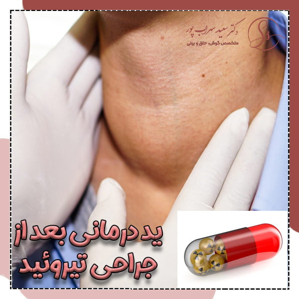 ید درمانی بعد از جراحی تیرویید - دکتر سهراب پور
